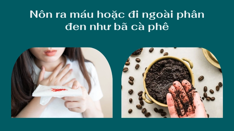 Sút cân nhanh không rõ lý do và luôn trong tình trạng mệt lả