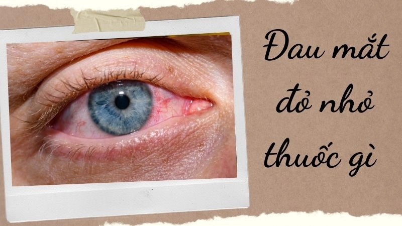 Nguyên nhân và dấu hiệu đau mắt đỏ thường gặp